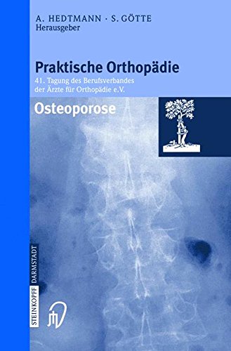 Osteoporose (Praktische Orthopädie Proceeding 41)