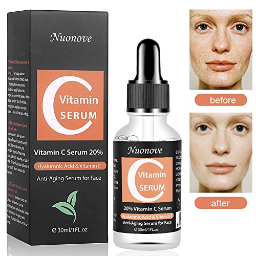 Vitamin C Serum mit Hyaluronsäure, Anti-Aging Gesichtsserum, Hyaluronsäure Serum für Gesicht, HOCHDOSIERT mit Hyaluronsäure / Anti-Aging / Für empfindliche unreine Haut. 30ML