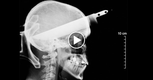 10 Schockierende Fakten über Ärzte !