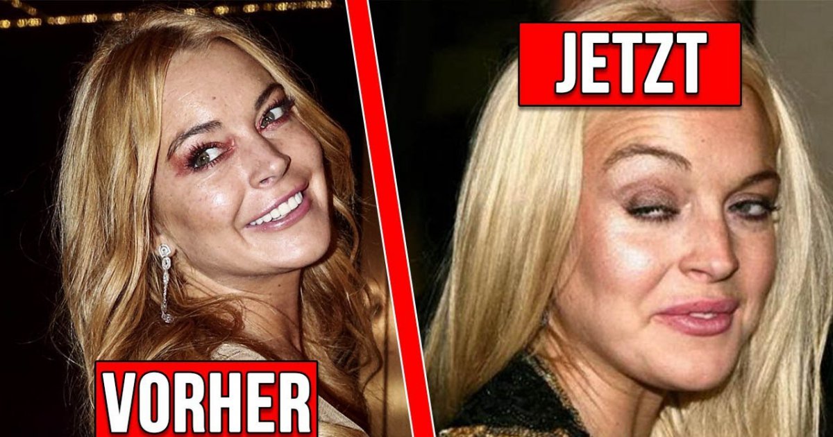 5 Kinderstars die du niemals wieder erkennen wirst!