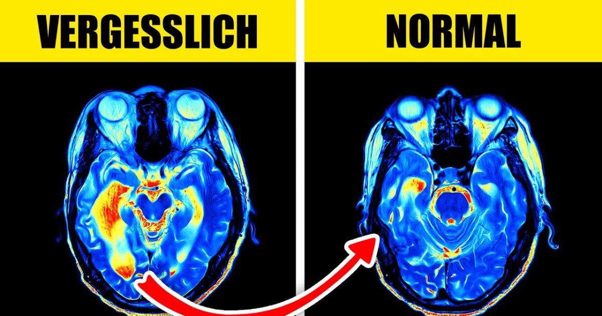 Du VERGISST oft Dinge? Dann bist du besonders INTELLIGENT!