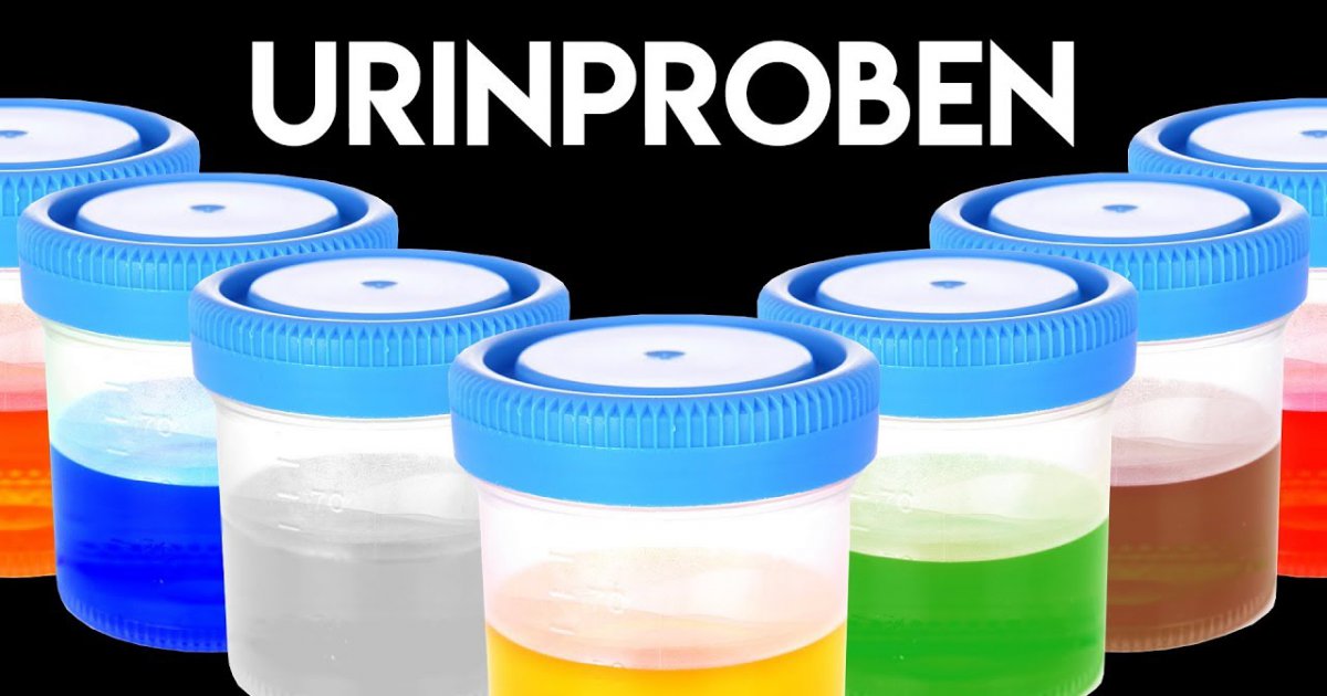 Das sagt dein PIPI über deine Gesundheit aus!